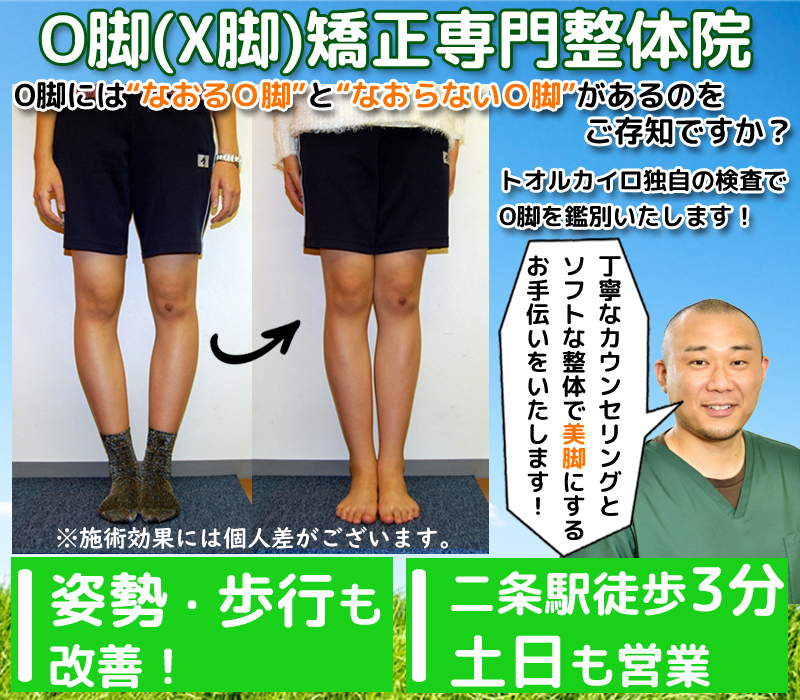O脚には”なおるO脚”と”なおらないO脚”があるのをご存知ですか？　京都の整体トオルカイロプラクティック独自の検査でO脚を鑑別し、一緒に”美脚に矯正”するお手伝いをいたします